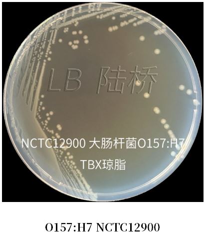 GB 4789.38－2025《食品安全國家標(biāo)準(zhǔn)　食品微生物學(xué)檢驗(yàn)　大腸埃希氏菌計(jì)數(shù)》解讀